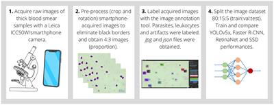 iMAGING: a novel automated system for malaria diagnosis by using artificial intelligence tools and a universal low-cost robotized microscope